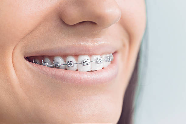 Best Veneers and Lumineers  in Star Valley, AZ